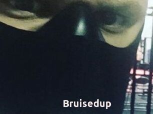 Bruisedup