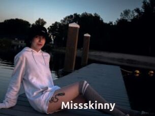 Missskinny